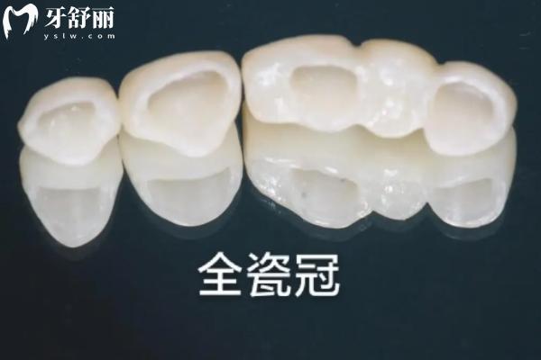 2024贛州牙科收費標準