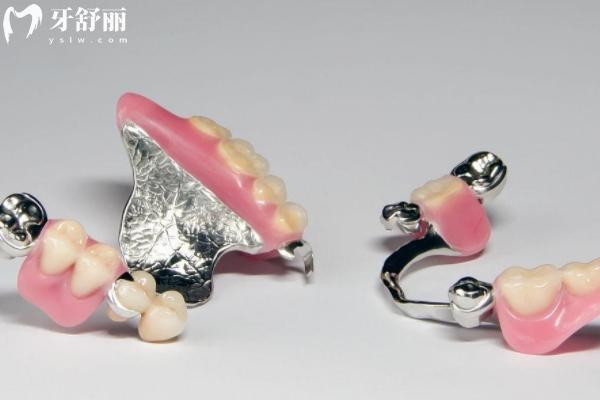 北京全口假牙要多少錢