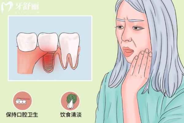 種植牙 (5).jpg