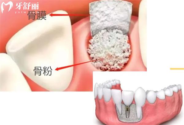 西寧時(shí)光諾貝爾口腔種植牙口碑評(píng)價(jià)