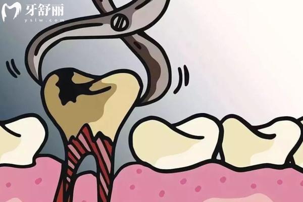 全新溫嶺朗德口腔醫(yī)院收費(fèi)標(biāo)準(zhǔn):根管治療400+種植牙1580+矯正880+