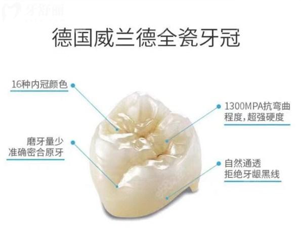 進(jìn)口全瓷牙