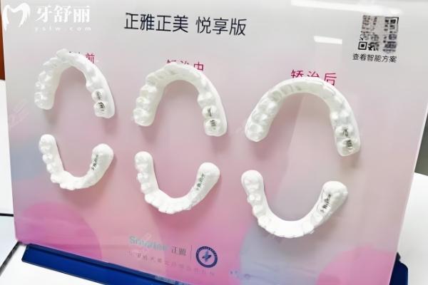 興國愛潔口腔價目表