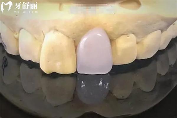 長(zhǎng)春看牙大概多少錢