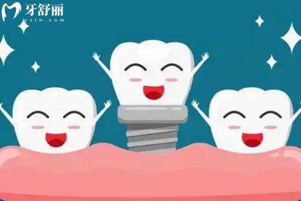 宣城種牙多少錢一顆?國產(chǎn)/韓國/美國/德國/瑞典4000-16000價(jià)格公布