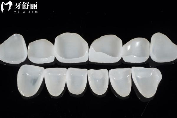 ??VITA琥珀瓷貼面