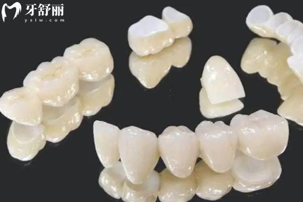 愛爾創(chuàng)全瓷牙冠質保幾年