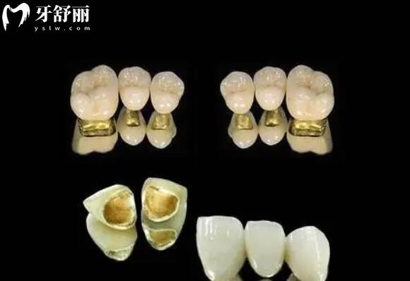 成都**口腔醫(yī)院收費標準2025種植牙/牙齒矯正/拔牙/補牙多少錢一目了然