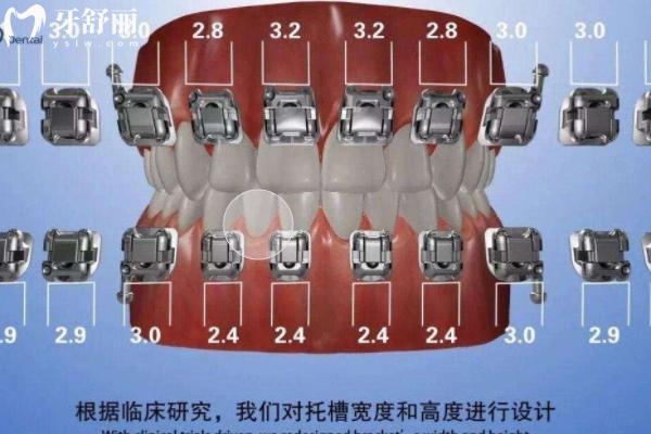 O-eyes歐睛自鎖牙套