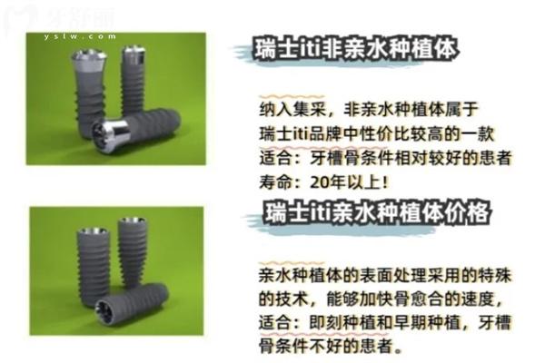 上海種植牙一顆多少錢