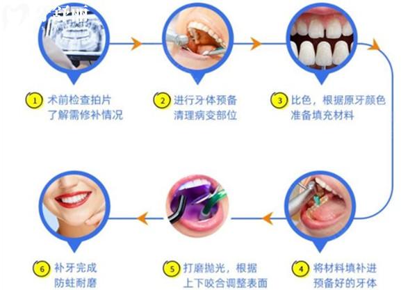 十歲孩子補(bǔ)牙，長(zhǎng)大后還需要補(bǔ)嗎