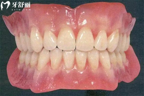 國(guó)內(nèi)常用全口義齒種類有哪些？大概多少錢一副？