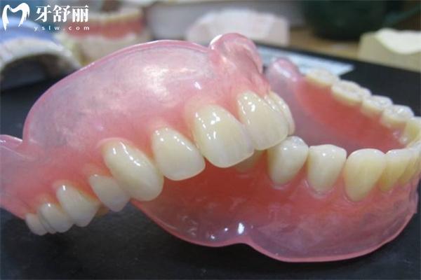國(guó)內(nèi)常用全口義齒種類有哪些？大概多少錢一副？