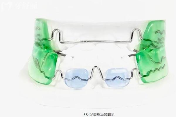 呼和浩特正規(guī)口腔醫(yī)院2025收費標(biāo)準已出:種植牙1980+牙齒矯正5800+