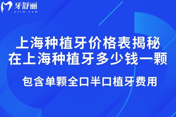 2025上海種植牙價(jià)格表揭秘在上海種植牙多少錢一顆!包含單顆全口半口植牙費(fèi)用