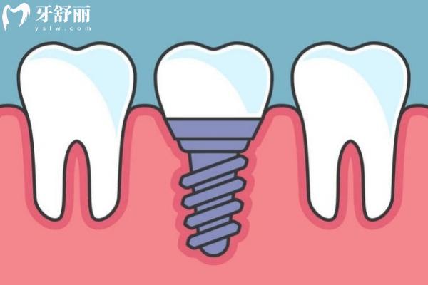 湖北黃岡蘄春英博爾口腔門(mén)診部收費(fèi)價(jià)格表