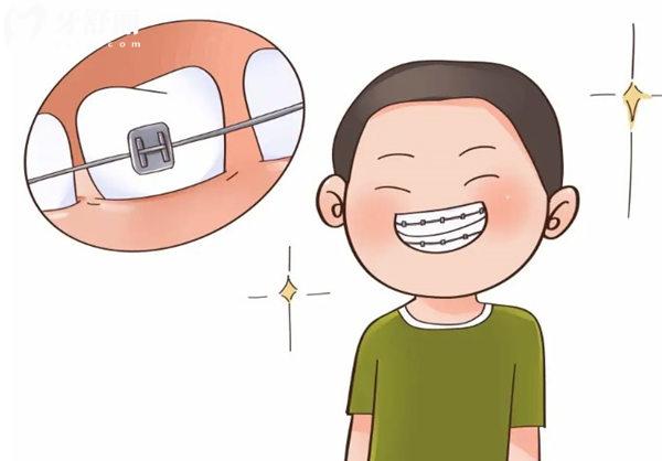 深圳龍崗區(qū)的口腔醫(yī)院2025牙齒矯正價格表