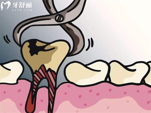 深圳龍崗區(qū)的口腔醫(yī)院2025拔牙價格表