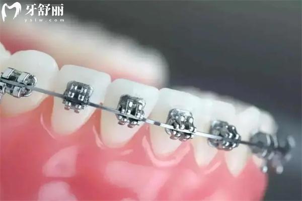 上新25版福州口腔醫(yī)院價格表:種植牙2880+牙齒矯正9800+鑲牙冠880+