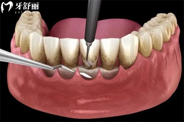 上新25版福州口腔醫(yī)院價格表:種植牙2880+牙齒矯正9800+鑲牙冠880+