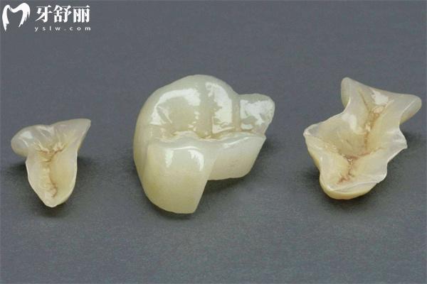 2025沈陽(yáng)牙科醫(yī)院價(jià)格表更新 種植牙2380+牙齒矯正7800+補(bǔ)牙128+