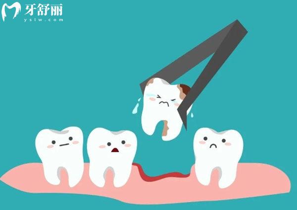 惠州口腔醫(yī)院拔牙多少錢一顆