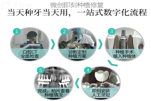 深圳做全口種植牙費(fèi)用價(jià)目表