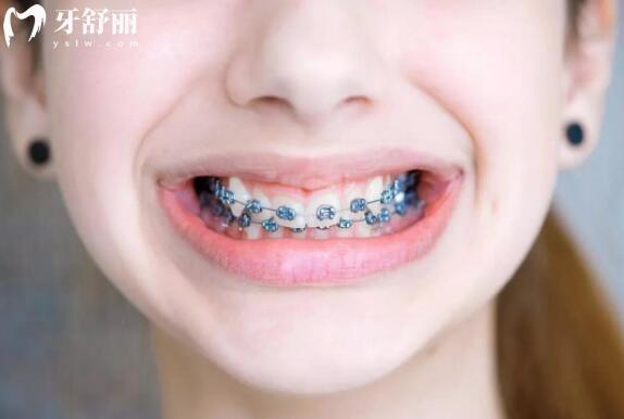 2025鹽城倍美口腔醫(yī)院看牙價(jià)格表公開(kāi):補(bǔ)牙268+