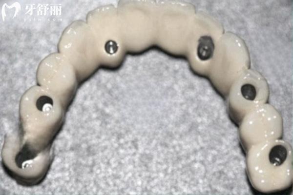 昌平正規(guī)牙科價(jià)格表