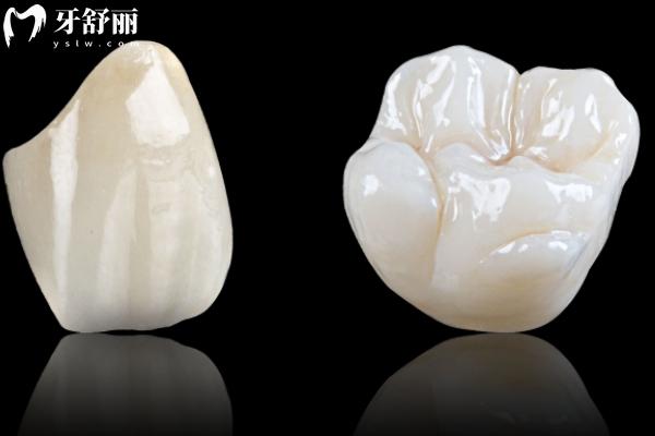 上海全瓷牙冠多少錢一顆