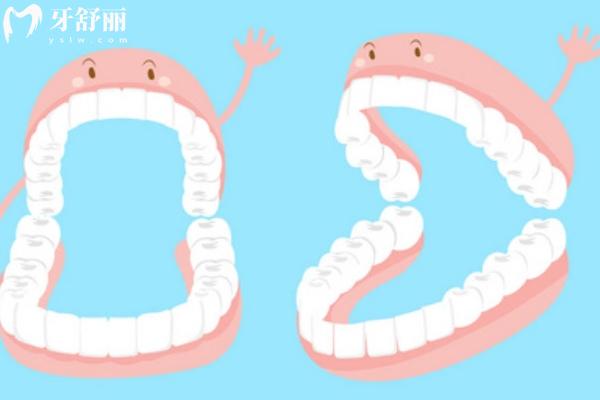 補(bǔ)牙用樹脂還是嵌體好？不同材質(zhì)使用壽命和價(jià)格對比
