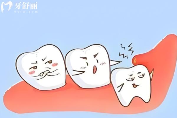 邵陽拔智齒要花多少錢？
