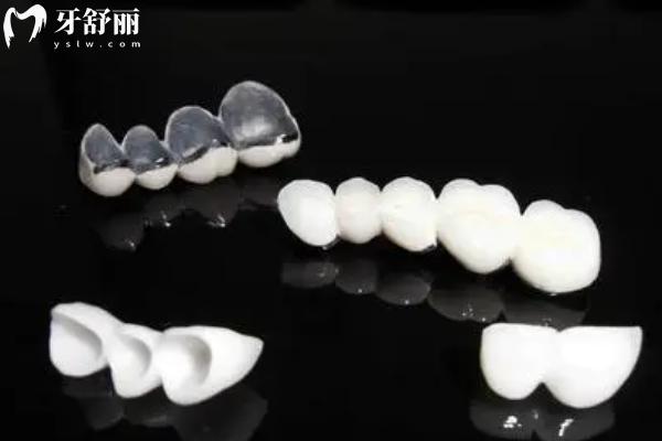 宿遷看牙貴不貴？宿遷口腔醫(yī)院價格表