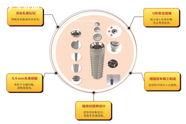 查詢新版深圳種植牙收費(fèi)標(biāo)準(zhǔn):集采單顆980+全口4w+即刻all-on4全口6w+附醫(yī)院名單