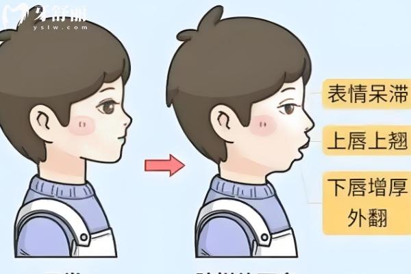 西安牙齒矯正價格表更新