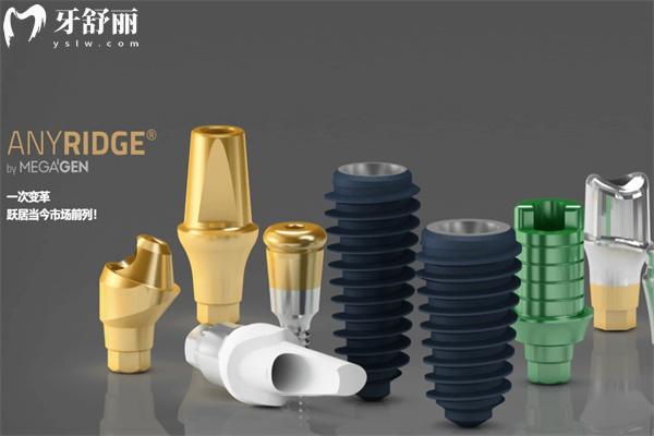 綿陽種植牙價(jià)格詳細(xì)表及綿陽做種植牙比較好的口腔醫(yī)院排名榜單分享