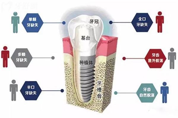 全新的太原口腔醫(yī)院價(jià)目表在這里!種植牙2200+牙齒矯正6800+拔牙68+