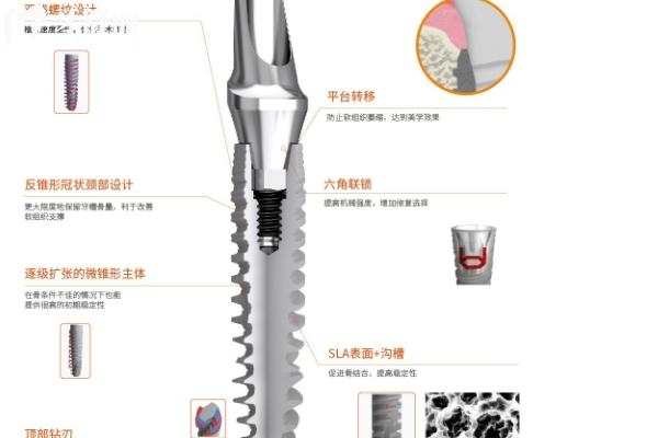 聊城種植牙價(jià)格2025版收費(fèi)標(biāo)準(zhǔn)