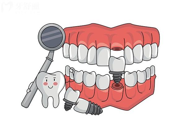 廣州荔灣區(qū)正規(guī)口腔醫(yī)院價格表