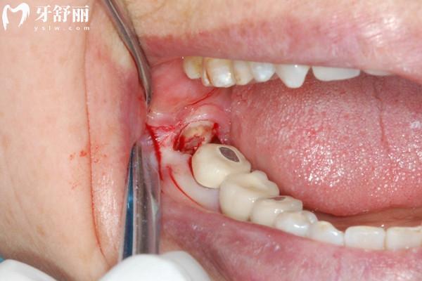 南昌牙科醫(yī)院收費(fèi)價(jià)目表