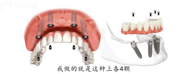 看牙費(fèi)用大降!2025北**腔醫(yī)院收費(fèi)標(biāo)準(zhǔn)(附北京十大正規(guī)牙科醫(yī)院排名)