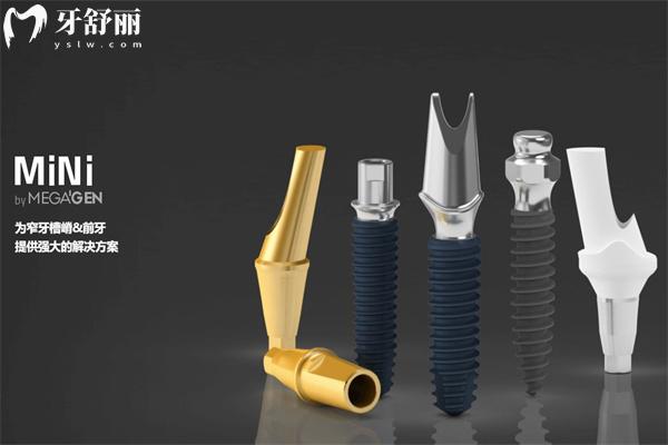 青島種植牙多少錢(qián)一顆2025價(jià)格表已出 單顆牙2k元+全口種牙3.6w元+
