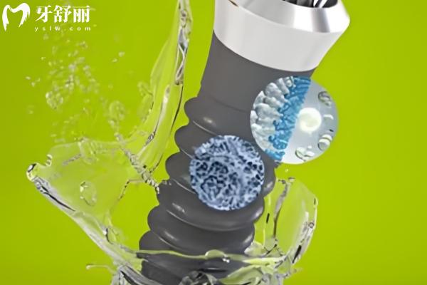 2025武漢中諾口腔種植牙價格表