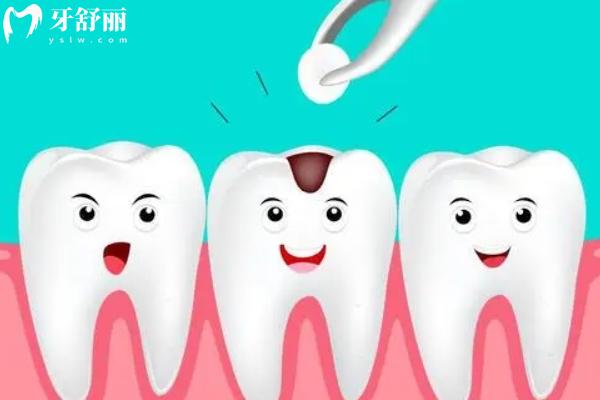 納米樹(shù)脂補(bǔ)牙值不值得做