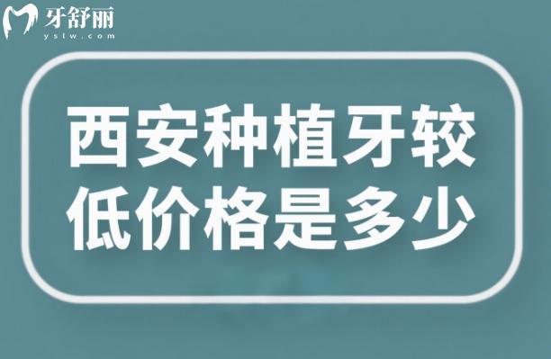 西安種植牙較低價格是多少
