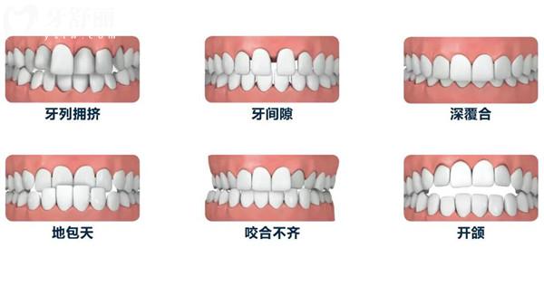 上海英博口腔醫(yī)院收費標準合集(2025版)附上3家連鎖店分院地址/交通路線