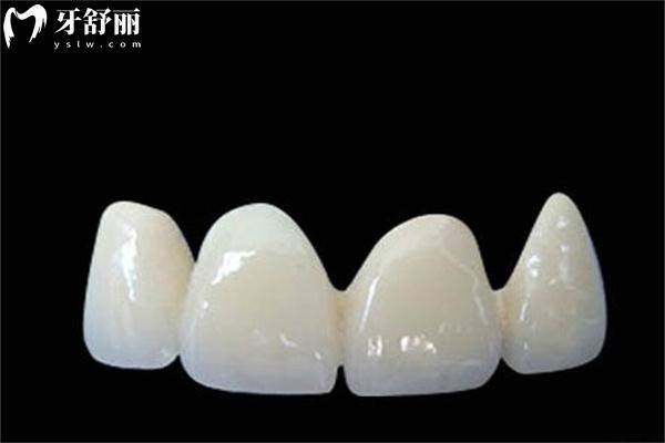 新版深圳牙科醫(yī)院收費標準:25年拔牙/補牙/鑲牙/種牙/矯牙/治療明細公開