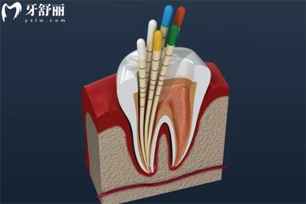 新版深圳牙科醫(yī)院收費標準:25年拔牙/補牙/鑲牙/種牙/矯牙/治療明細公開