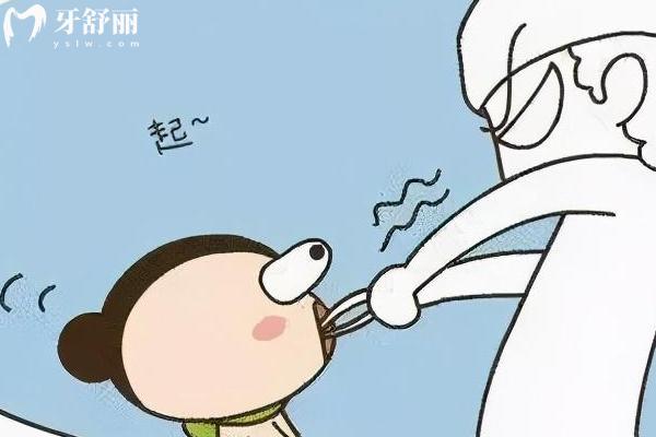 智齒蛀牙是拔好還是補？綜合考慮智齒的生長位置、蛀牙程度、身體狀況等