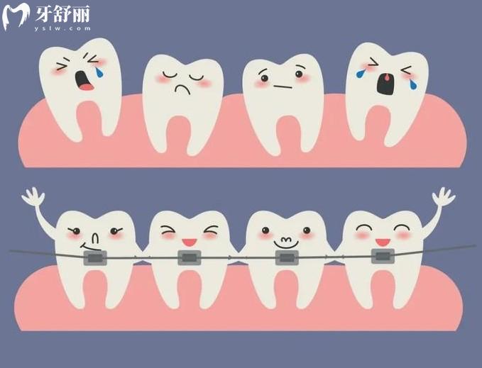 柳州口腔醫(yī)院牙齒矯正多少錢(qián)